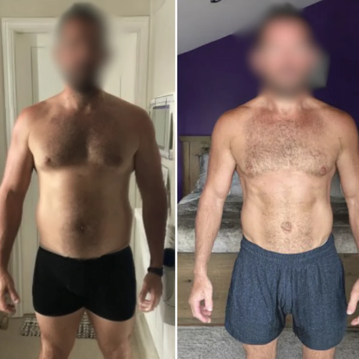 Alex before after results Dubai transformation