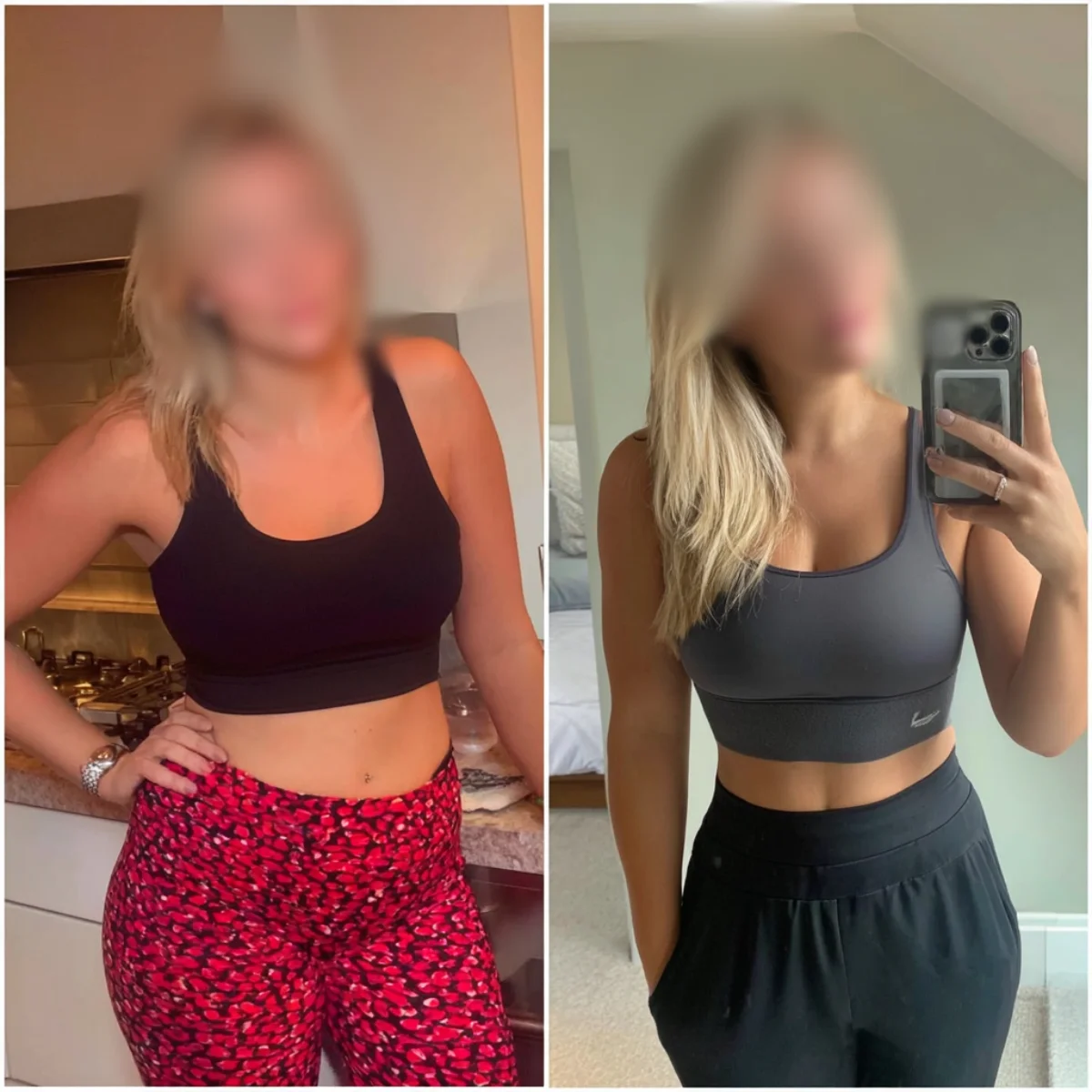 Holly before after results Dubai transformation